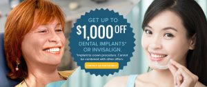 Coupon for dental implants and Invisalign